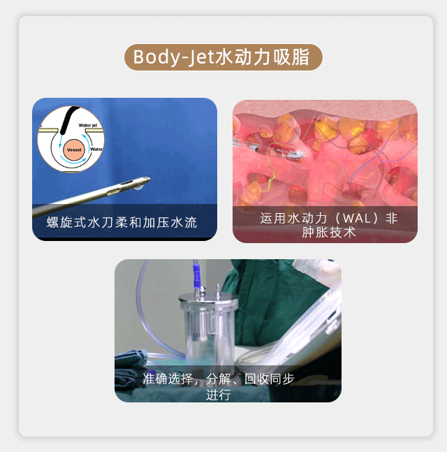 水动力吸脂