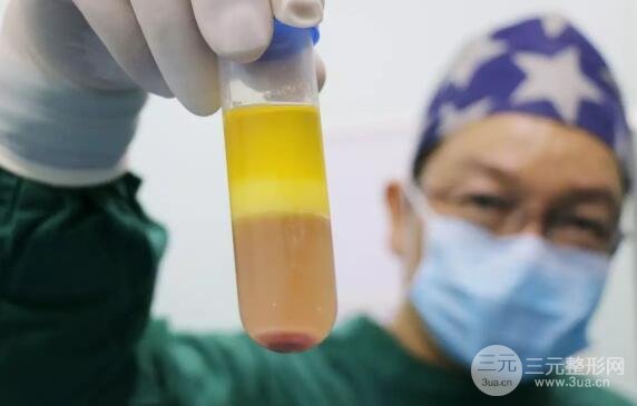 为什么有些人只做一次,而其他人做两三次?