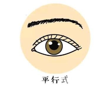 平行双眼皮