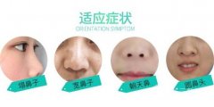 鼻尖矫正手术怎么做？隆鼻后鼻尖下垂如何修复?