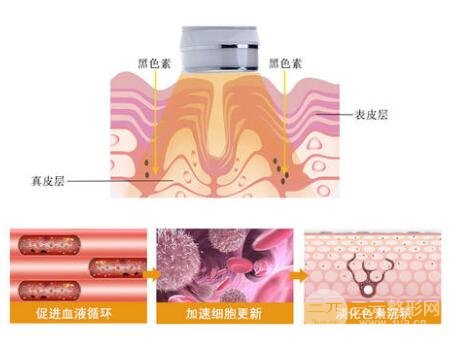 黑脸娃娃和普通的光子嫩皮肤有什么区别?