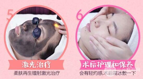 黑脸娃娃缓解通常需要多长时间?