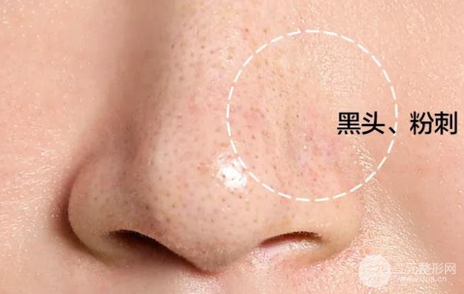 黑脸娃娃能维持多久?