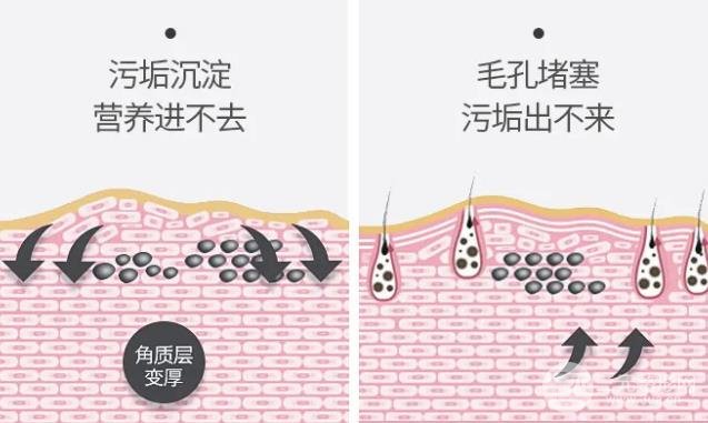 黑脸娃娃适合哪些人做