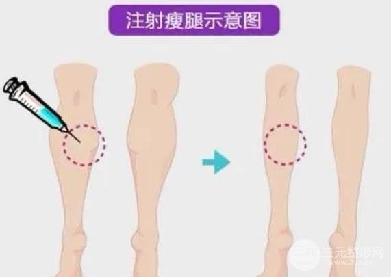 瘦小腿后的注意事项：