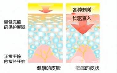 敏感肌