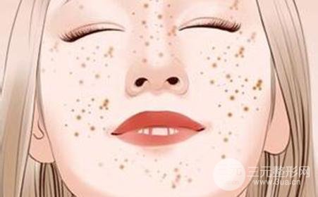 脸上色斑如何去除