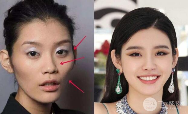 奚梦瑶