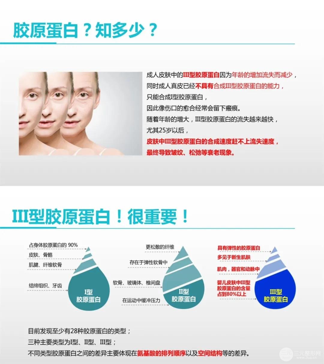 热玛吉刺激胶原蛋白