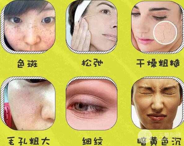 皮肤问题