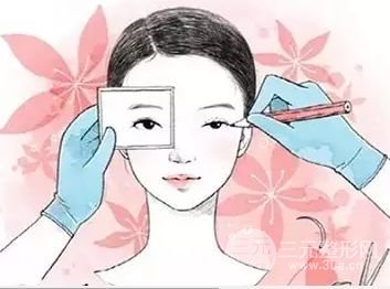 双眼皮失败的八种表现