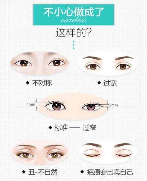 双眼皮失败图片