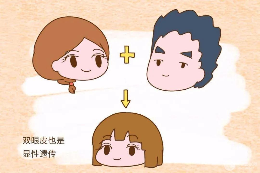 肿眼泡会不会遗传