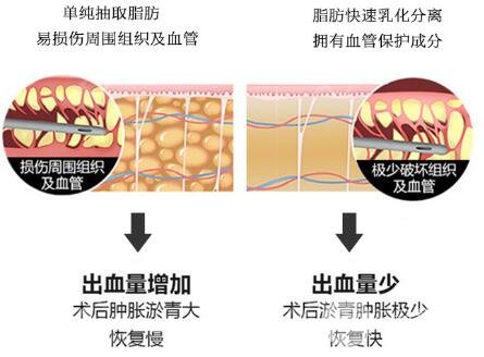 特点