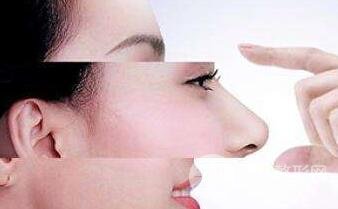 鼻子缩小手术的风险大吗?