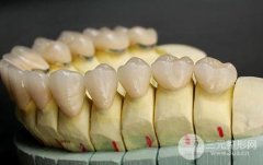 纯钛烤瓷牙价格多少?钛合金更便宜为什么不建议?