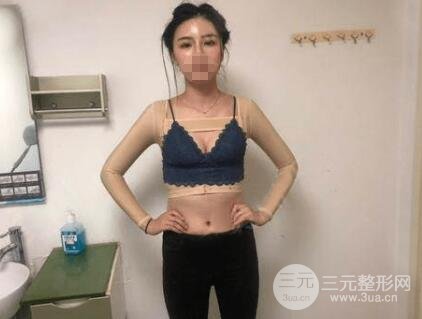 术后恢复过程