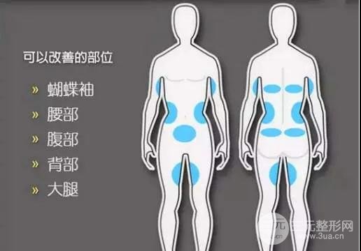 适用部位