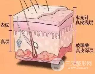 注射层次
