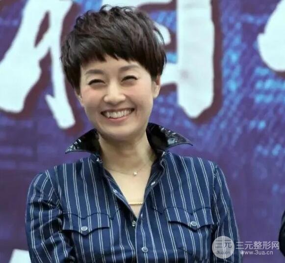 去眼袋手术图片恢复过程记录,图片大全