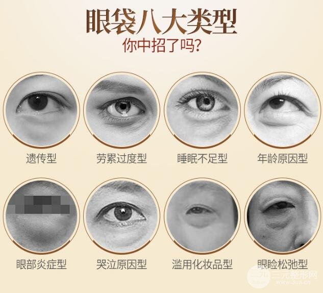 眼袋手术的价格是多少?