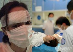 疤痕的缓解|头部摔伤创口长达6cm！难道ta要留疤破相颜值不保？