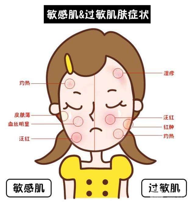 敏感肌