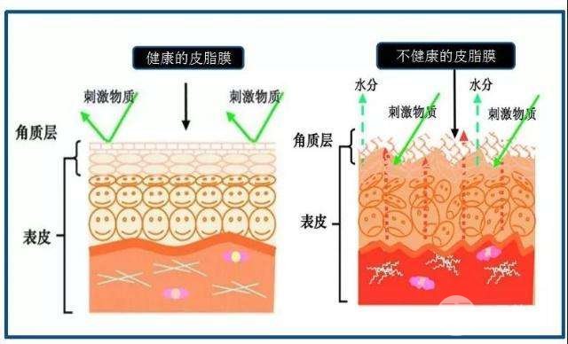 面部皮肤问题