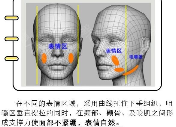 埋线除皱原理