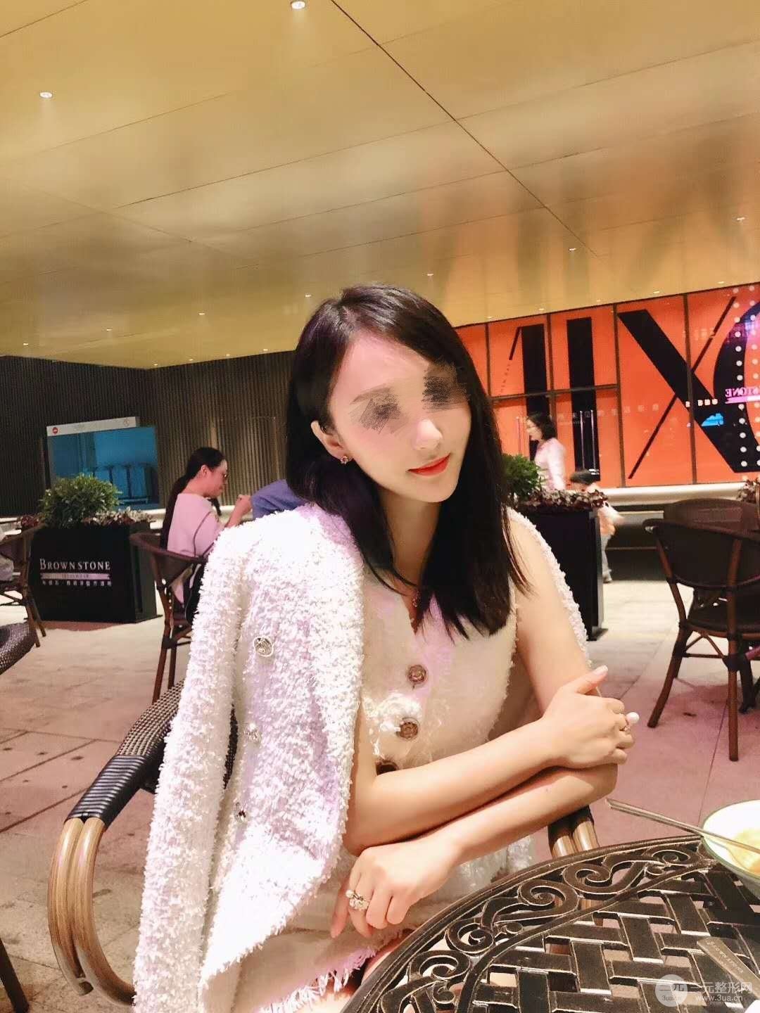 埋线除皱术后