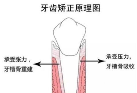 矫正原理