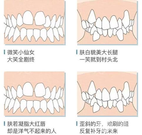 牙齿问题