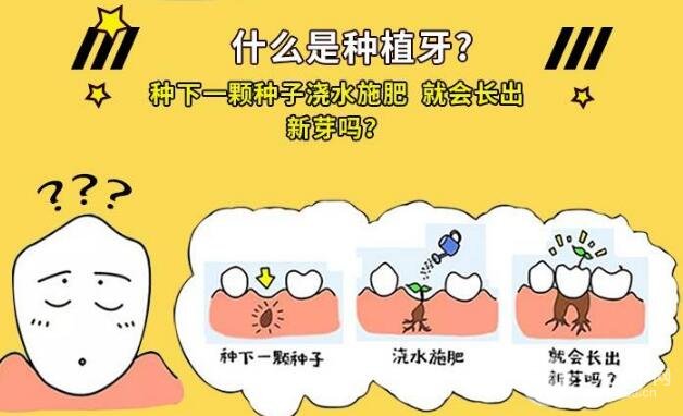 牙齿种植