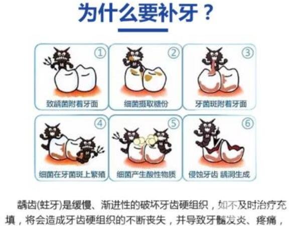 补牙问题