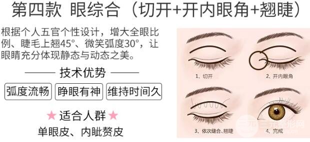 综合美眼手术基本原理