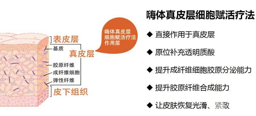 嗨体去颈纹