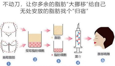 手术原理