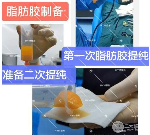 手术过程