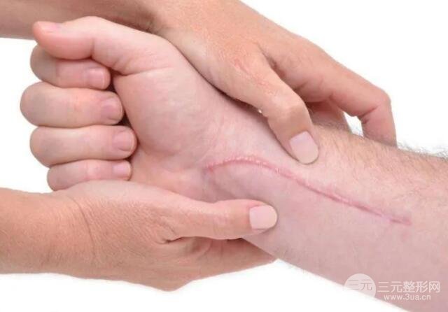 上海九院疤痕科有几个专家？疤痕修复价格是多少？