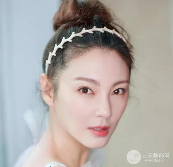 离异又漂亮的女明星 张雨绮
