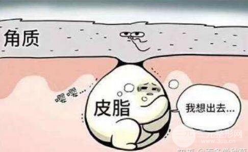 光子嫩肤去毛孔