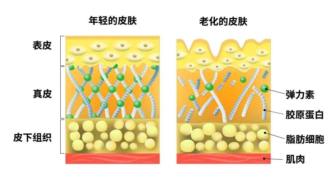 皮肤老化问题