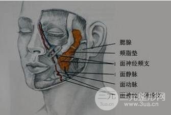 颊脂垫去除垫适合人群