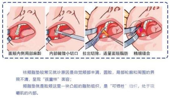 手术过程