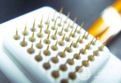 微针去痘印大概多少钱?分享我的医院微针经历 微针去痘印大概多少钱?分享我的医院微针经历