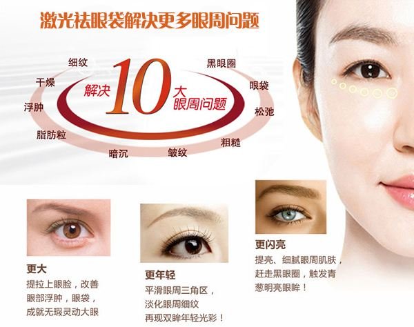 激光去眼袋