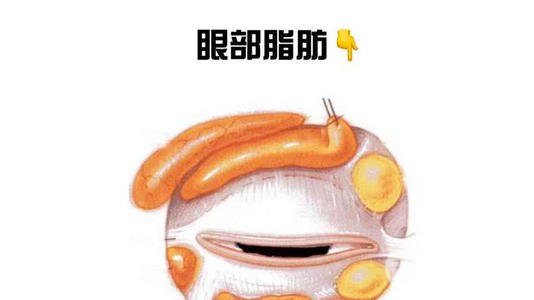 眼部吸脂手术有什么危害