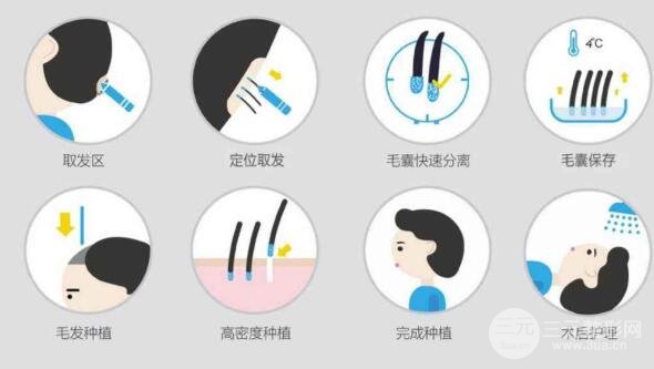 植发际线费用多少钱?价格表|收费标准