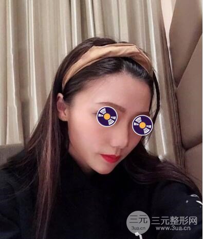 手术后多久可以上班?