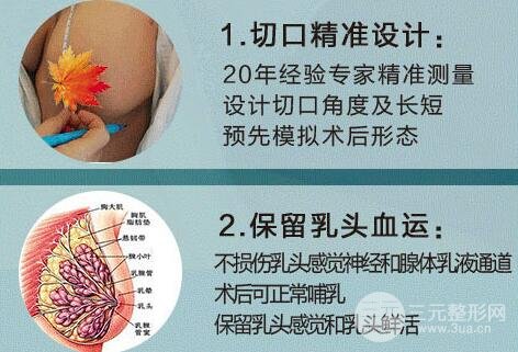 乳房缩小整形术科普
